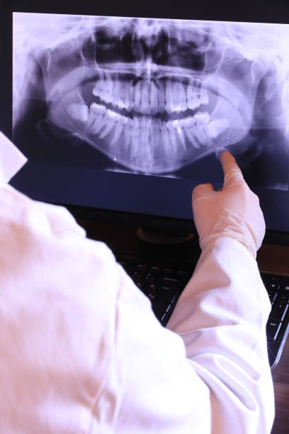 Best Emergency Broken Tooth Repair in Home Garden, CA